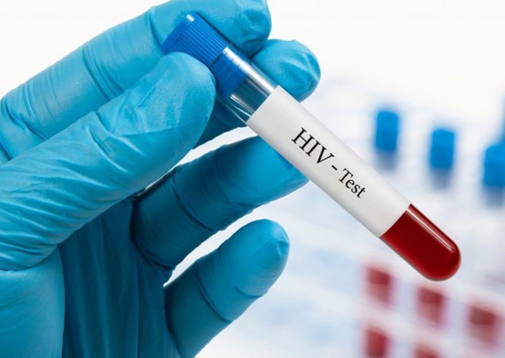  Скільки живуть люди з ВІЛ: сучасні прогнози та факти